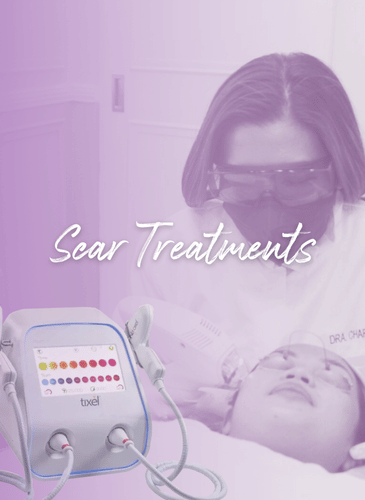 CHARM Scar Treatments Deep Acne Keloid Injection Laser La Union Region 1 Ilocos